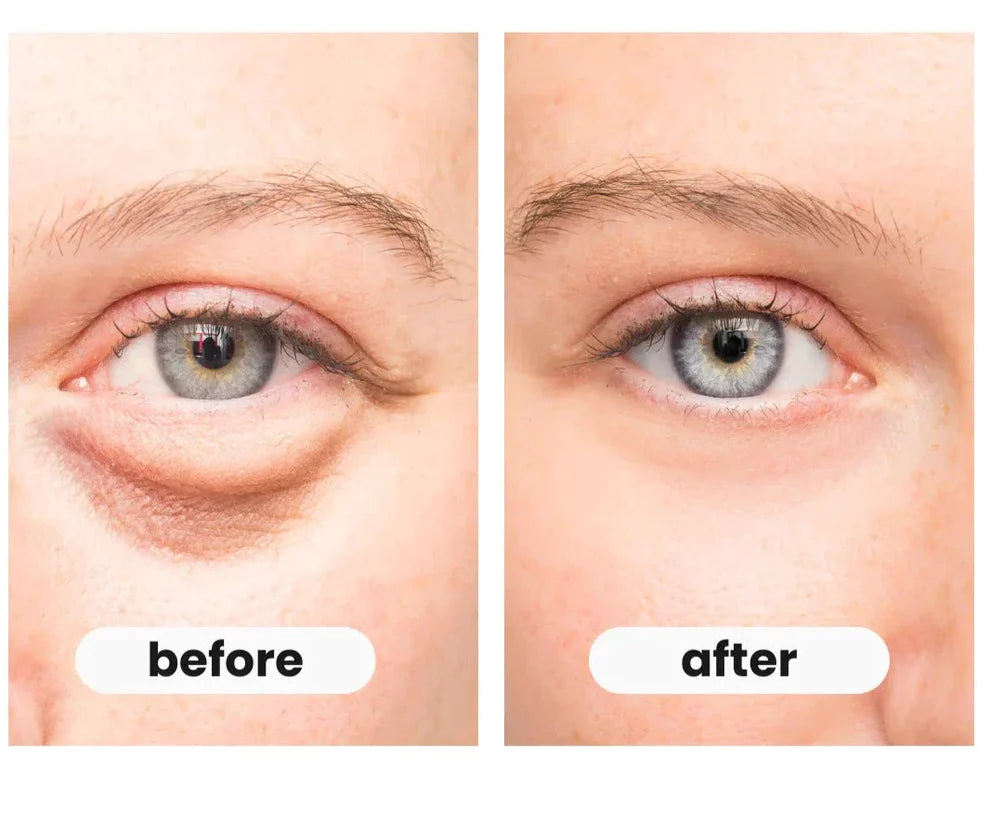 EyesRelax™ Pro