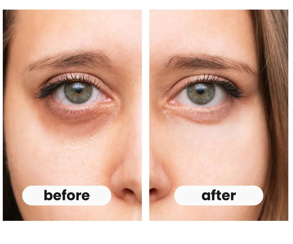 EyesRelax™ Pro